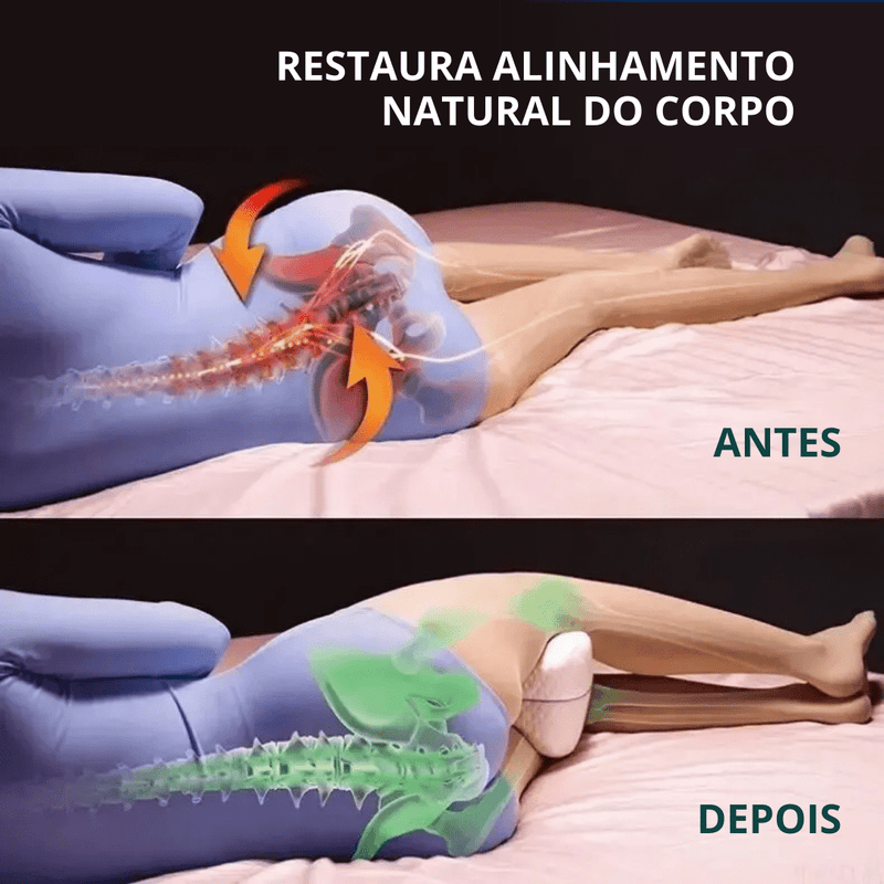 Travesseiro Ergonômico para Perna e Joelho – Espuma de Memória, Conforto para Quadril e Coluna