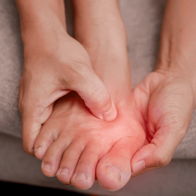 Protetor para Hálux Valgo (Joanete) – Redução do Atrito, Compressão e Uso Diário (Par)